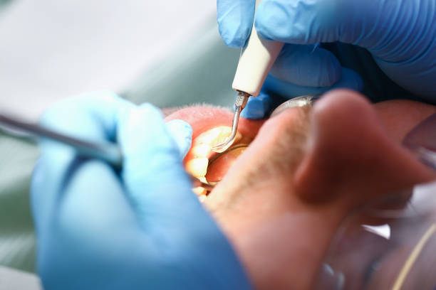 Best Urgent Care for Lost Fillings or Crowns in Lakeshire, MO